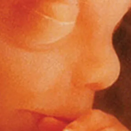 Fertility