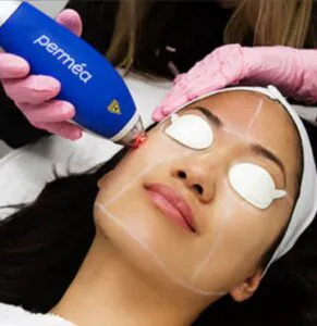 Woman receiving a laser skin treatment at a clinic. Woman receiving a laser skin treatment at a clinic.